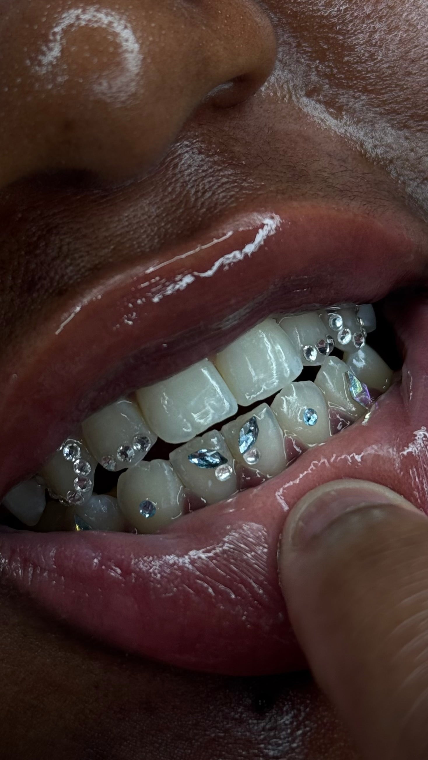 Custom 6+ teeth set made of preciosa crystals by icyfangsldn