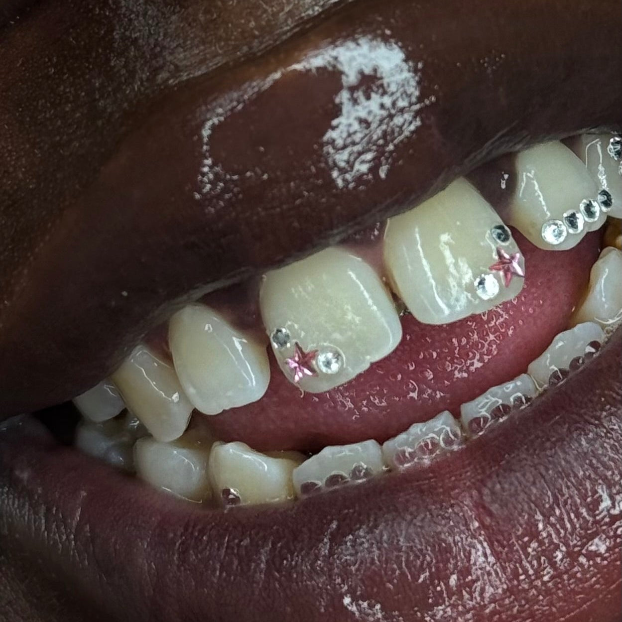 6 teeth tooth gem set by icyfangsldn
