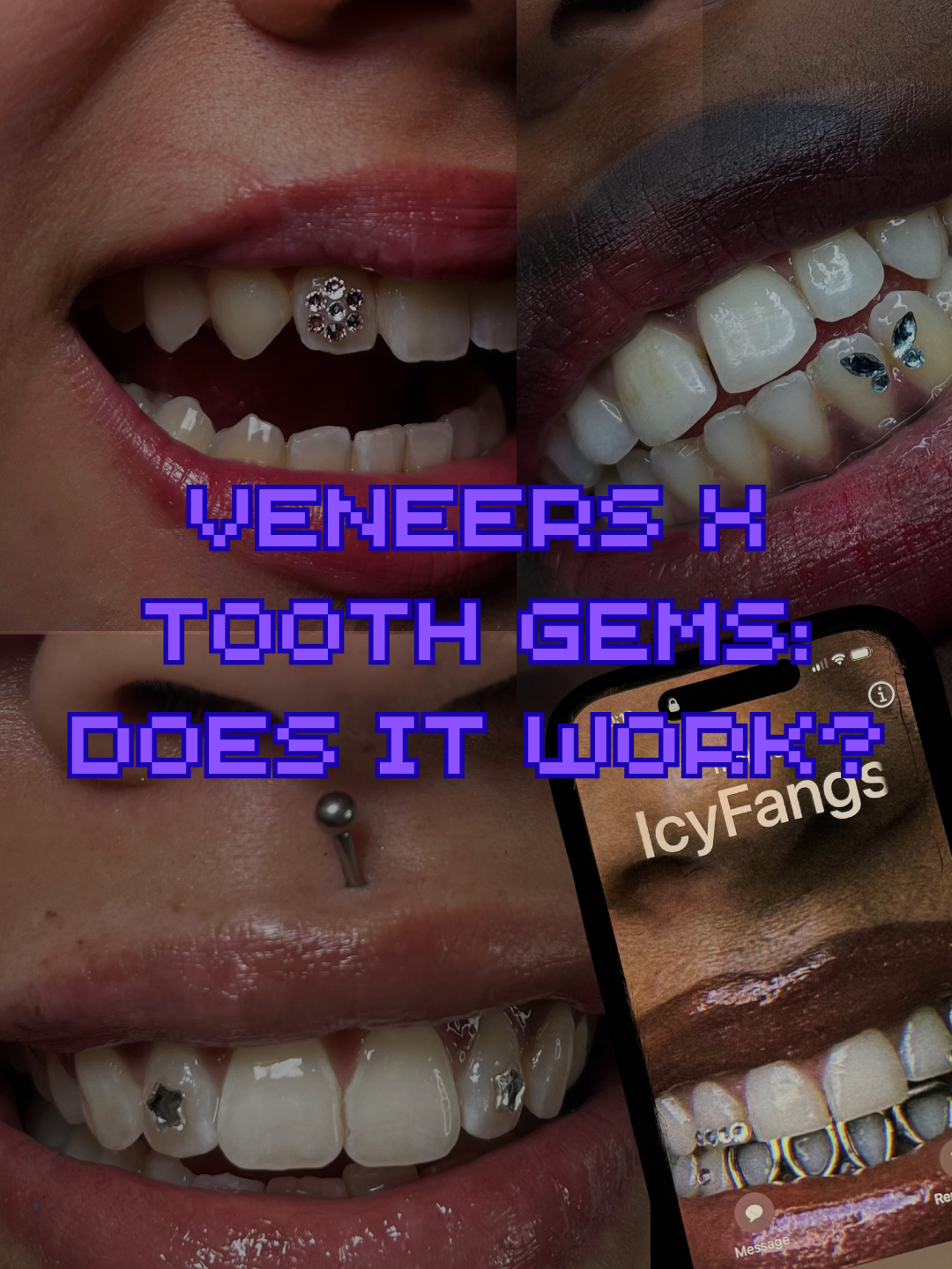 ✨ Why Tooth Gems Don’t Go on Veneers or Fake Teeth (And What to Do Instead)