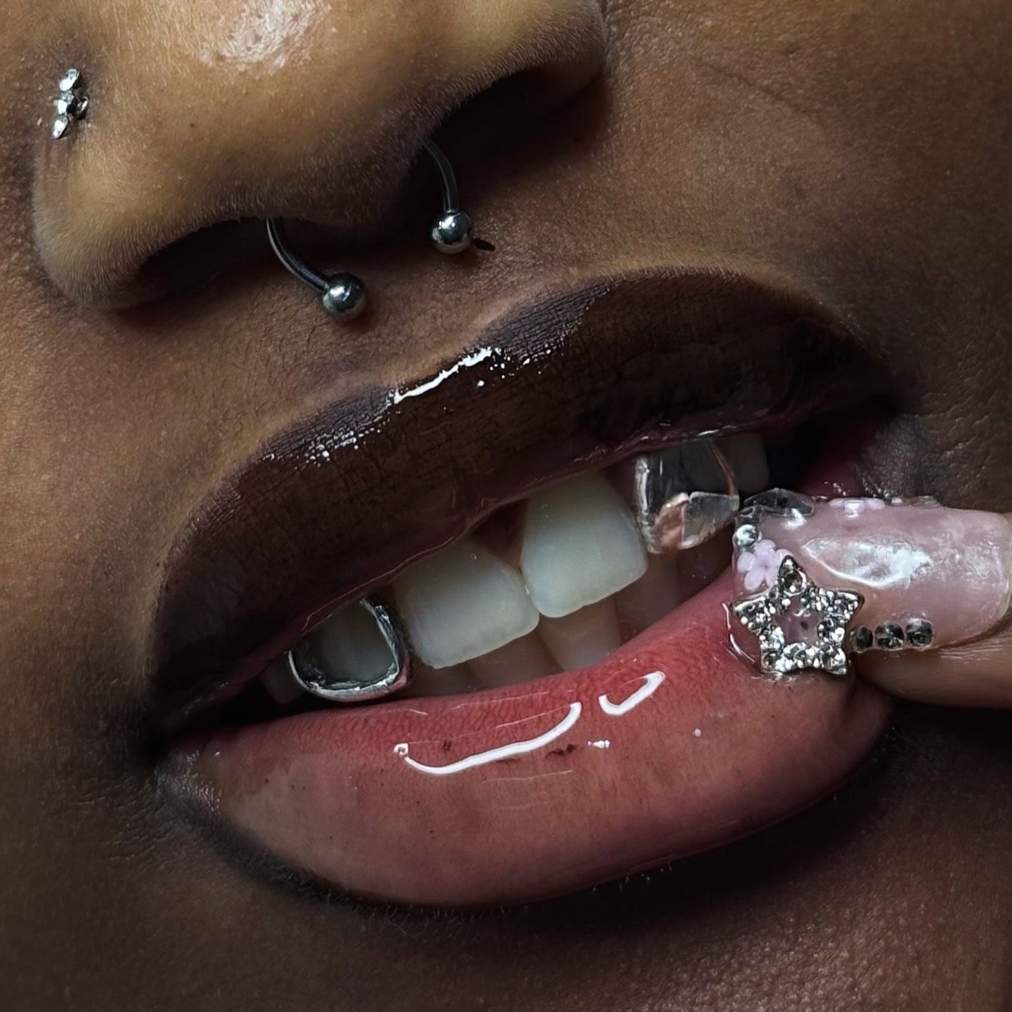 Silver Window and cap grillz, applied by icyfangsldn