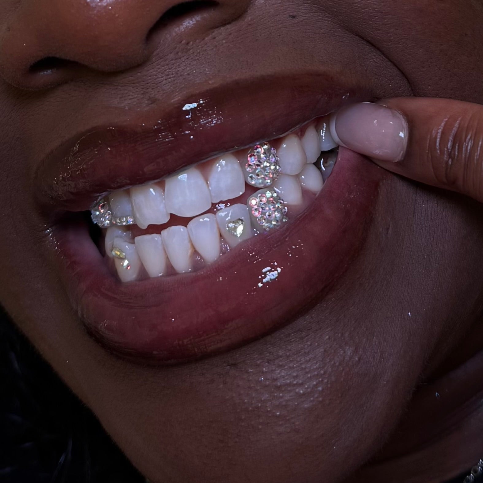South London tooth gems by icyfangsldn tooth gems near me